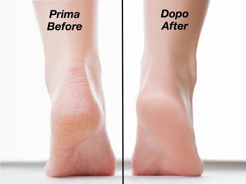 Pietra scrub esfoliante con azione depilatoria