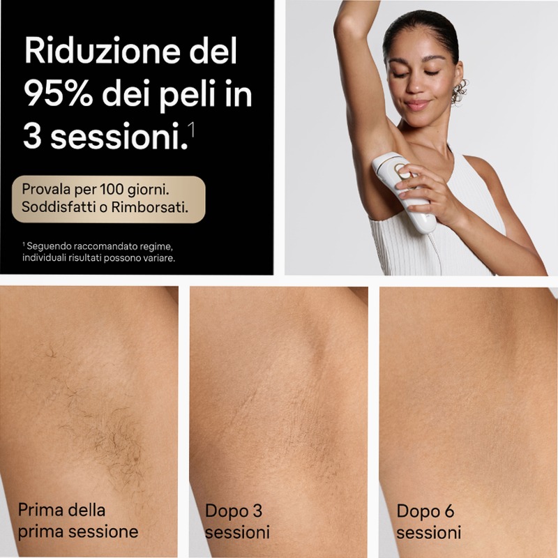 Braun Kit: Luce Pulsata e Accessori per Pelli Sensibili Sì
